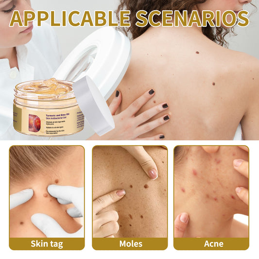 Turmeric Body Neck Cream Soothing And Drying